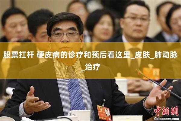 股票扛杆 硬皮病的诊疗和预后看这里_皮肤_肺动脉_治疗